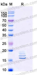 EHA70601, SDS-PAGE
