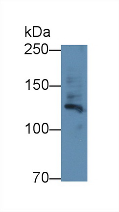12419