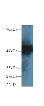 14579