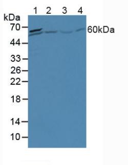 5993