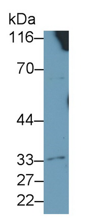 56664