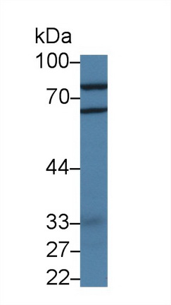 14306