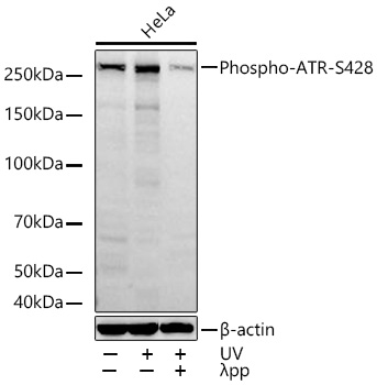 AP1582, вестерн-блоттинг, лизат клеток HeLa (28477)