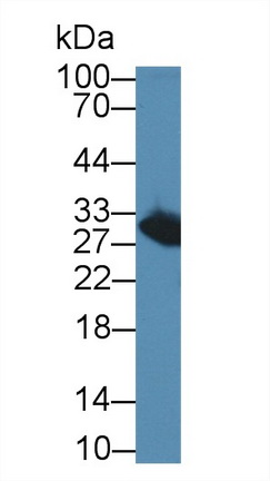 12714