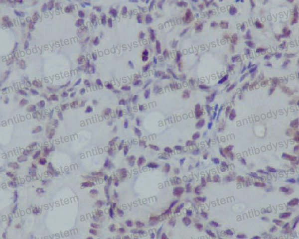 Валидация AntibodySystem RHF62713