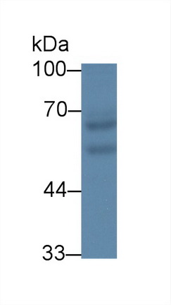 12741