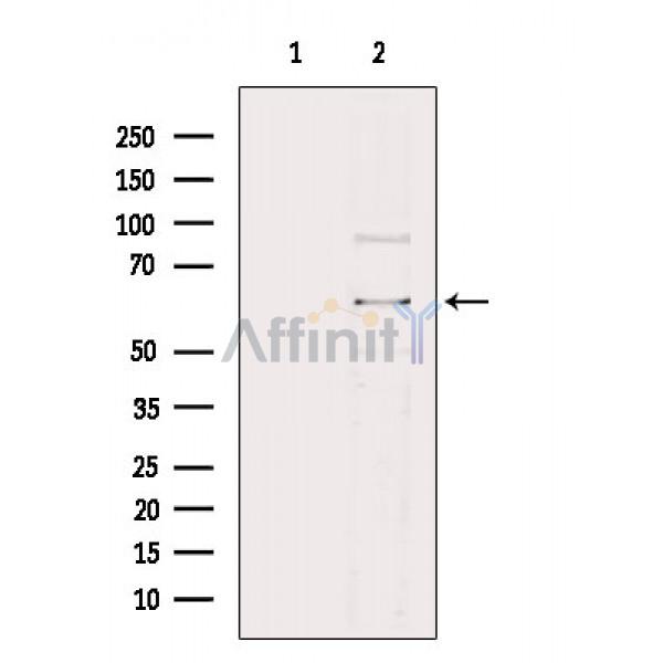 Валидация Affinity DF8582 - 20490