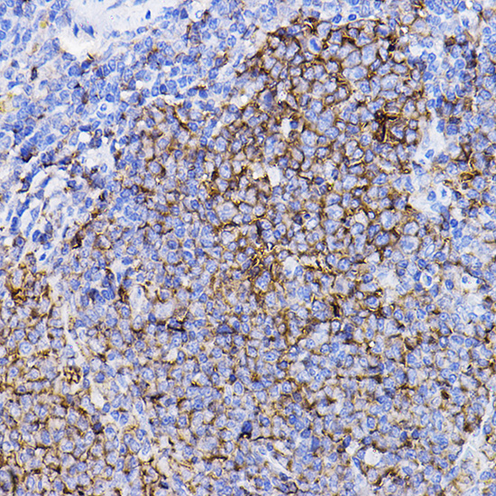 A11788, иммуногистохимия, срезы селезенки мыши (516)