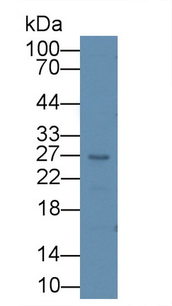 11913