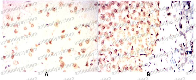 Валидация AntibodySystem RHG08704 (2834)
