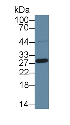 14103