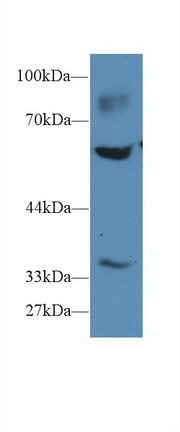 14557