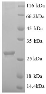 SDS-PAGE