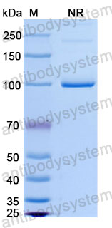 Валидация SDS-PAGE - AntibodySystem DHD37505