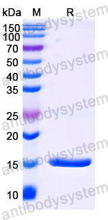 Валидация SDS-PAGE - AntibodySystem RHB88301