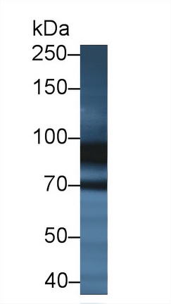 14381