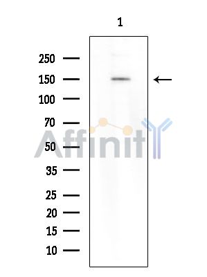 Валидация Affinity DF13844 - 9544