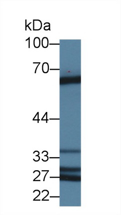 14394