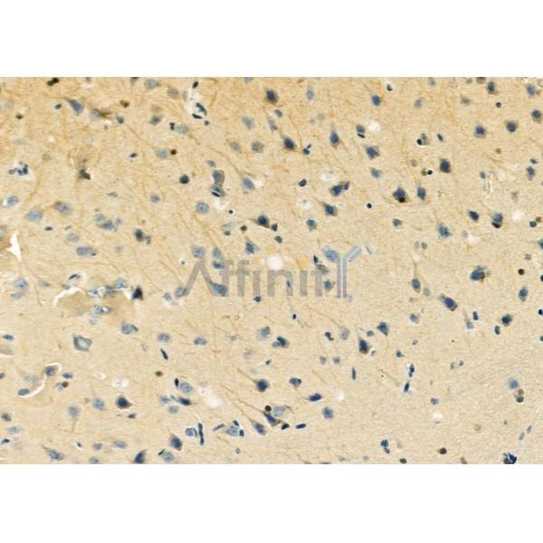 Валидация Affinity DF9635 - 22366