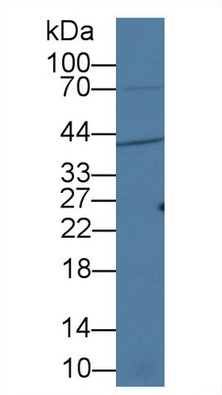 17663