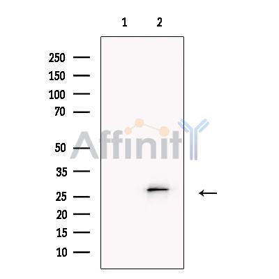 Валидация Affinity DF13695 - 9294