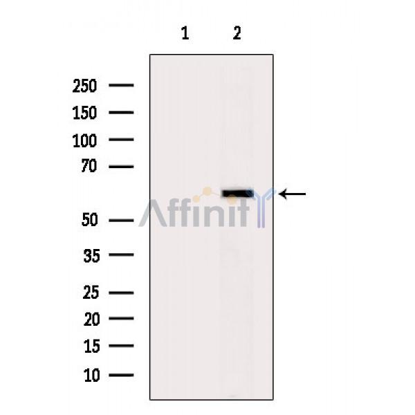Валидация Affinity DF6444 - 17824