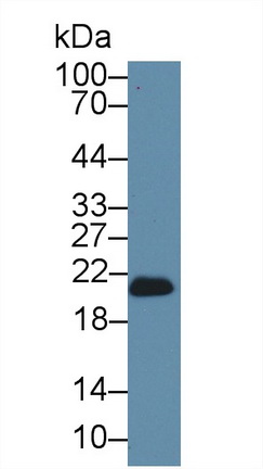 12773