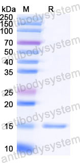 Валидация SDS-PAGE - AntibodySystem RHJ69203