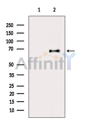 Валидация Affinity DF14148 - 9953