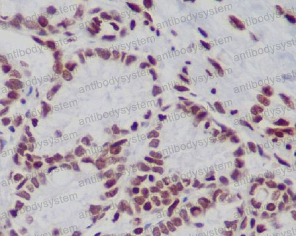Валидация AntibodySystem RHF62708 (2617)