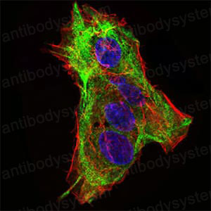 Валидация IF - AntibodySystem RHN28601
