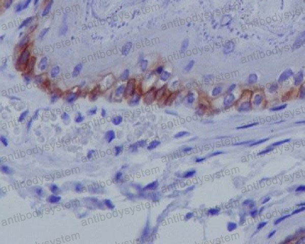 Валидация AntibodySystem RHJ81301