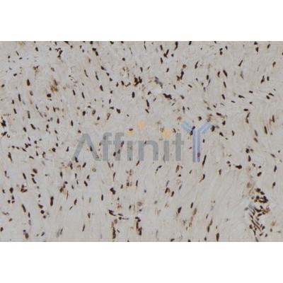 Валидация Affinity DF12170 - 6377