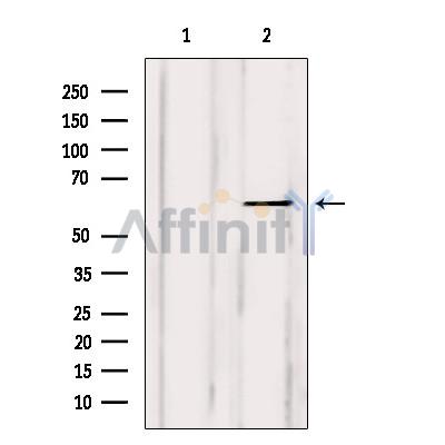 Валидация Affinity AF6298 - 3566