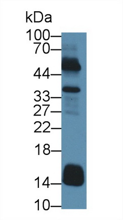 17599
