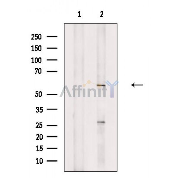 Валидация Affinity DF2672 - 13374