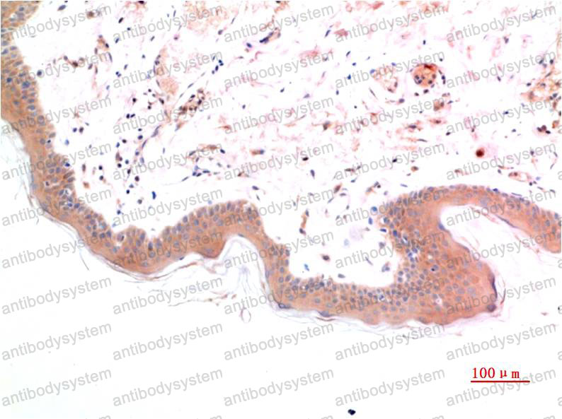 Валидация AntibodySystem RHF75507 (2657)