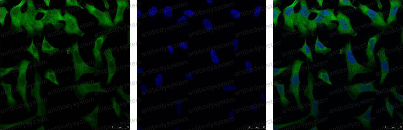 Валидация IF - AntibodySystem RHF37803