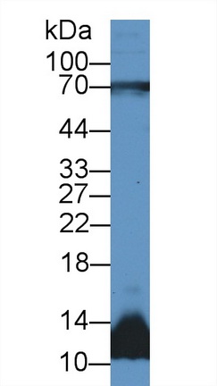 12587