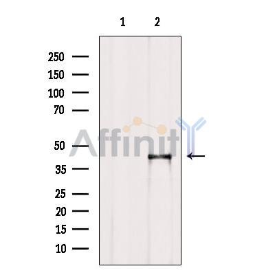 Валидация Affinity DF6215 - 17490
