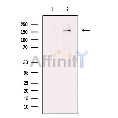 Валидация Affinity DF13396 - 8666