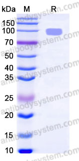 AHA30102, SDS-PAGE