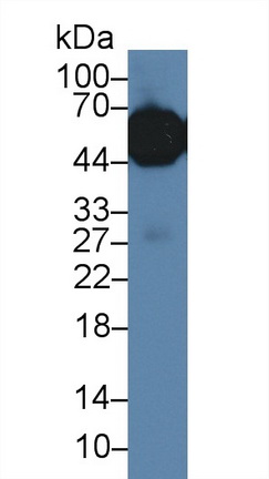 14004