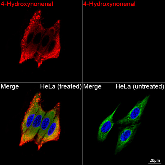 A26085, конфокальная микроскопия, клетки HeLa (22351)