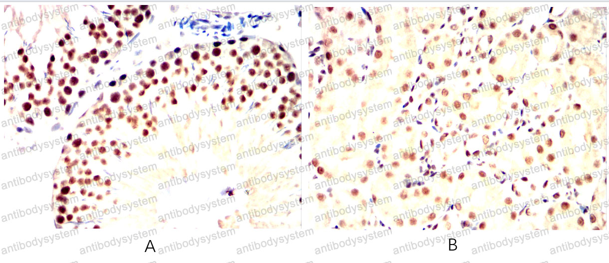 Валидация AntibodySystem RHJ38701 (3399)