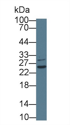 12756