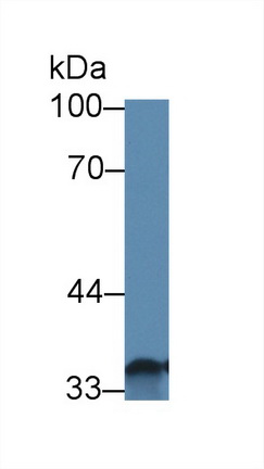 12382
