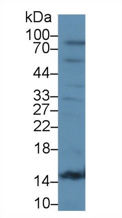 17594