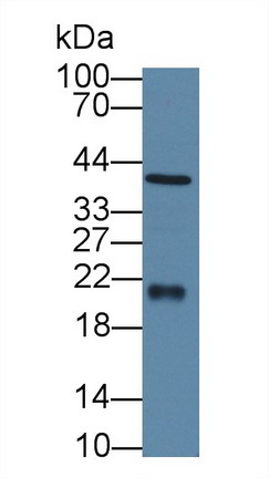 8915