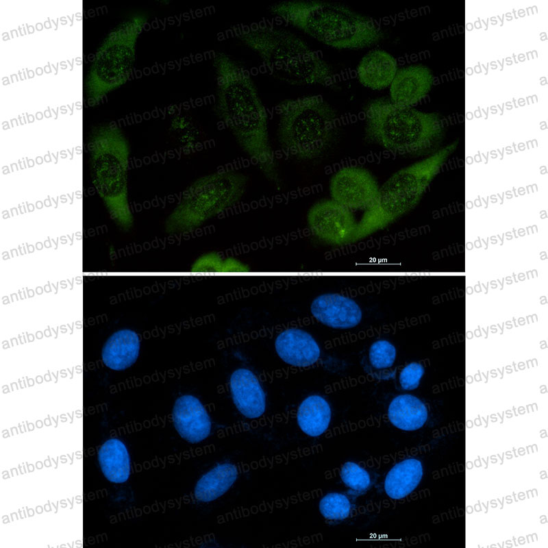 Валидация IF - AntibodySystem RHC27401